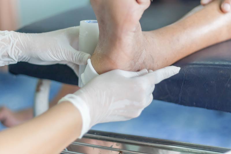 Diabetic foot care treatment from a Podiatrist